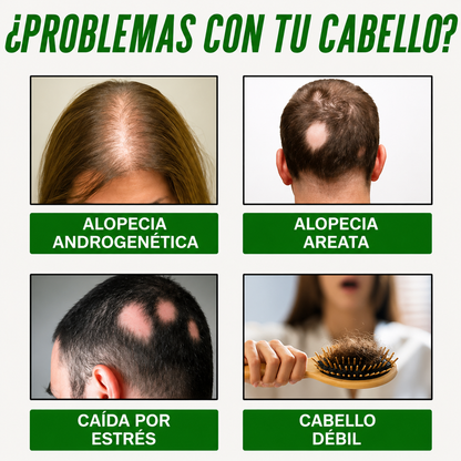 2X1 ACEITE DE BATANA - Hidratación y Fortalecimiento Capilar - 30ML